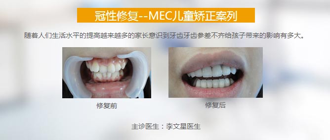 MRCͯݽЧ